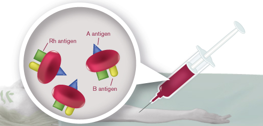 image of AB Rh+