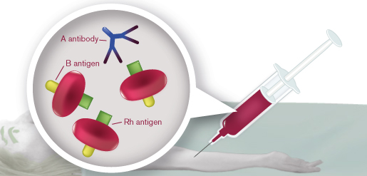 image of B Rh+