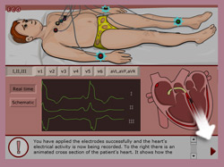 Help - the Electrocardiogram Game